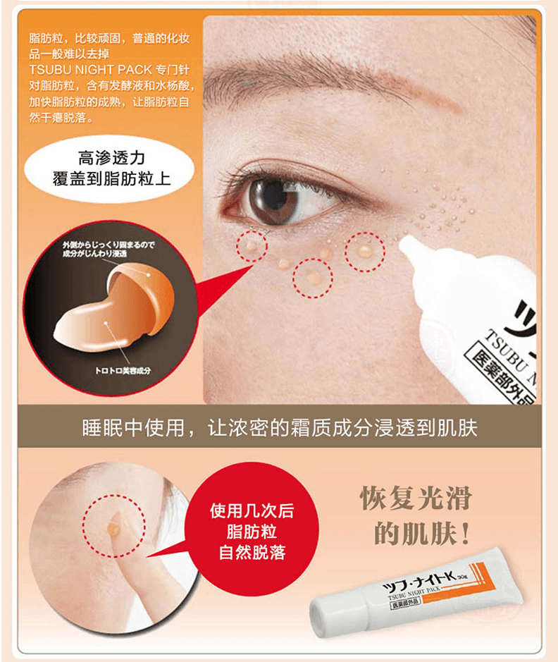 [日本直邮] CHEZ MOI 去脂肪粒 眼部 眼膜 30g