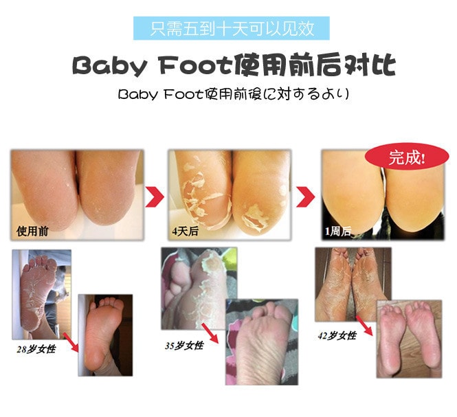日本LIBERTA BABY FOOT 深层去角质足膜 #M码 1对